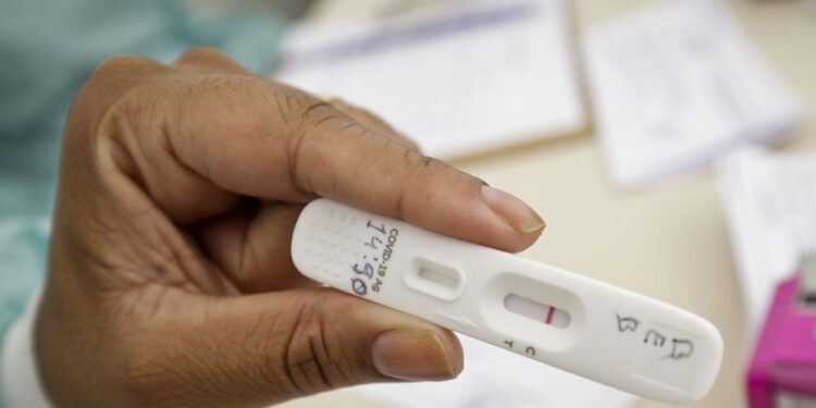 Covid-19: Anvisa recebe informações sobre implementação de autotestes