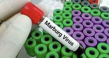 Vírus de Marburg, um dos mais letais do mundo, tem surto confirmado pela OMS