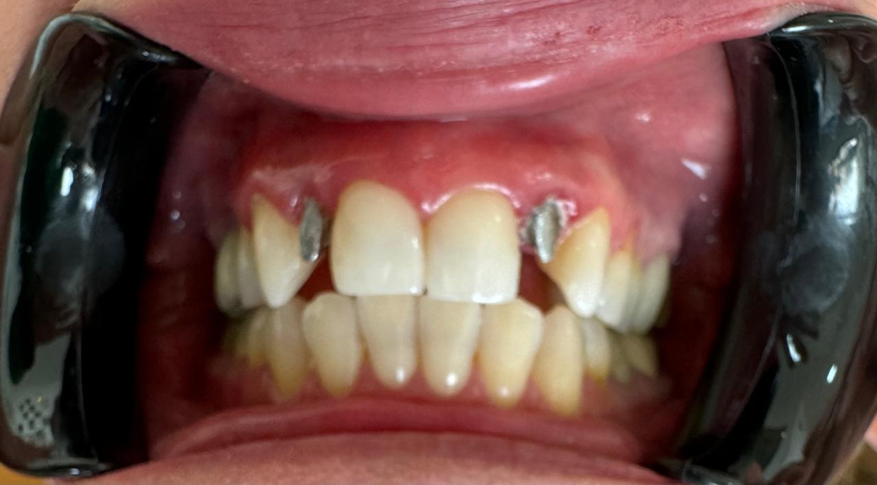 A Arte de Transformar Sorrisos: Uma Conversa com a Dra. Sandra Selma 48 c52e9de0 b5dc 4761 9e9c 17a2186b827e