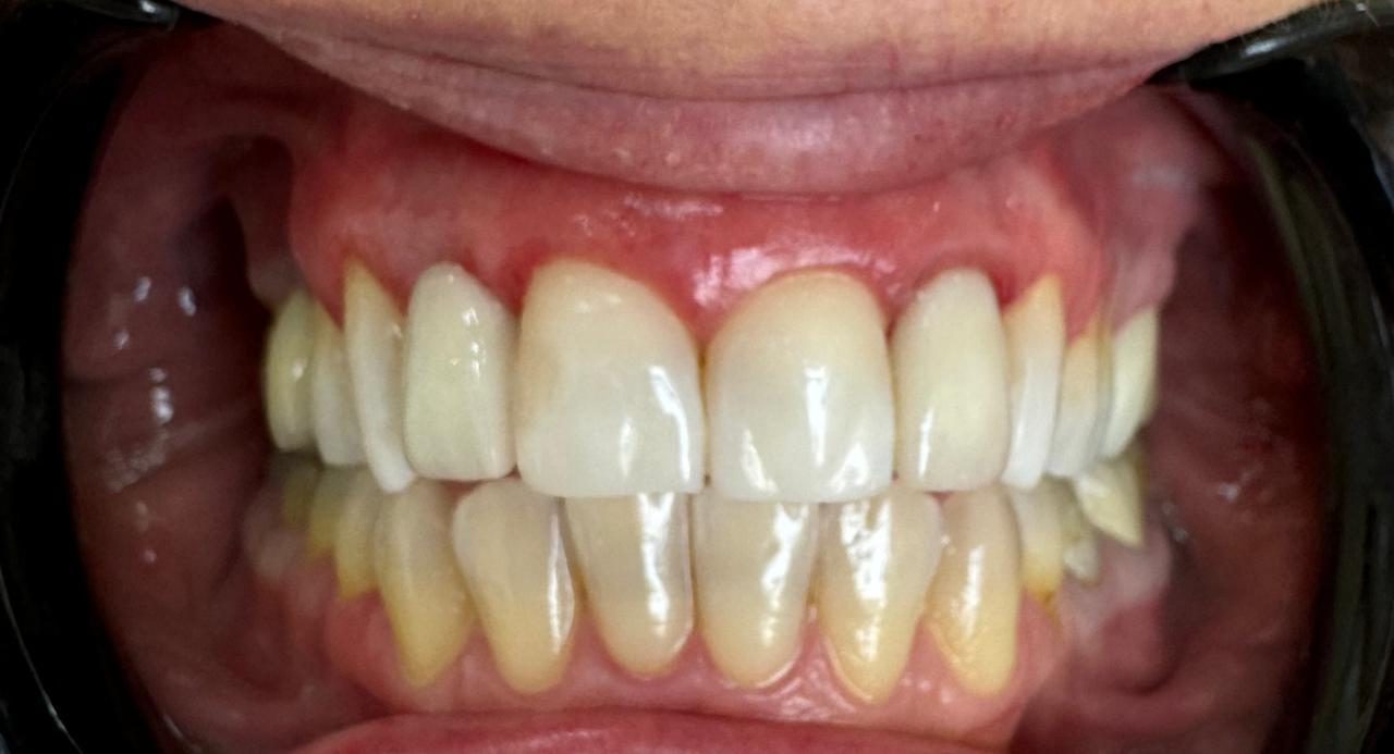 A Arte de Transformar Sorrisos: Uma Conversa com a Dra. Sandra Selma 49 eeae3278 2d66 4c68 b3f1 ce151c44f388