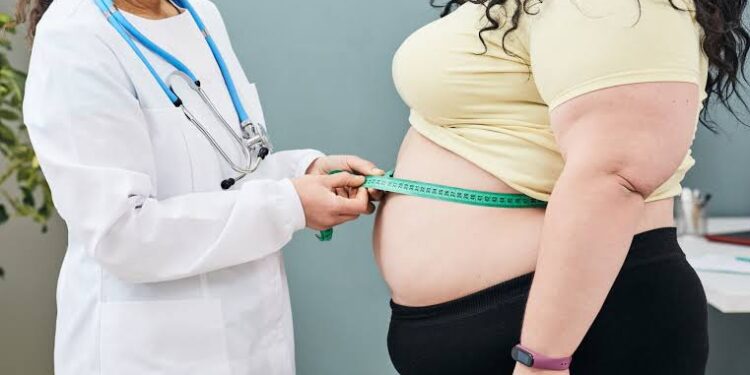 Obesidade no Brasil: um alerta urgente à saúde pública 45 Obesidade no Brasil: um alerta urgente à saúde pública