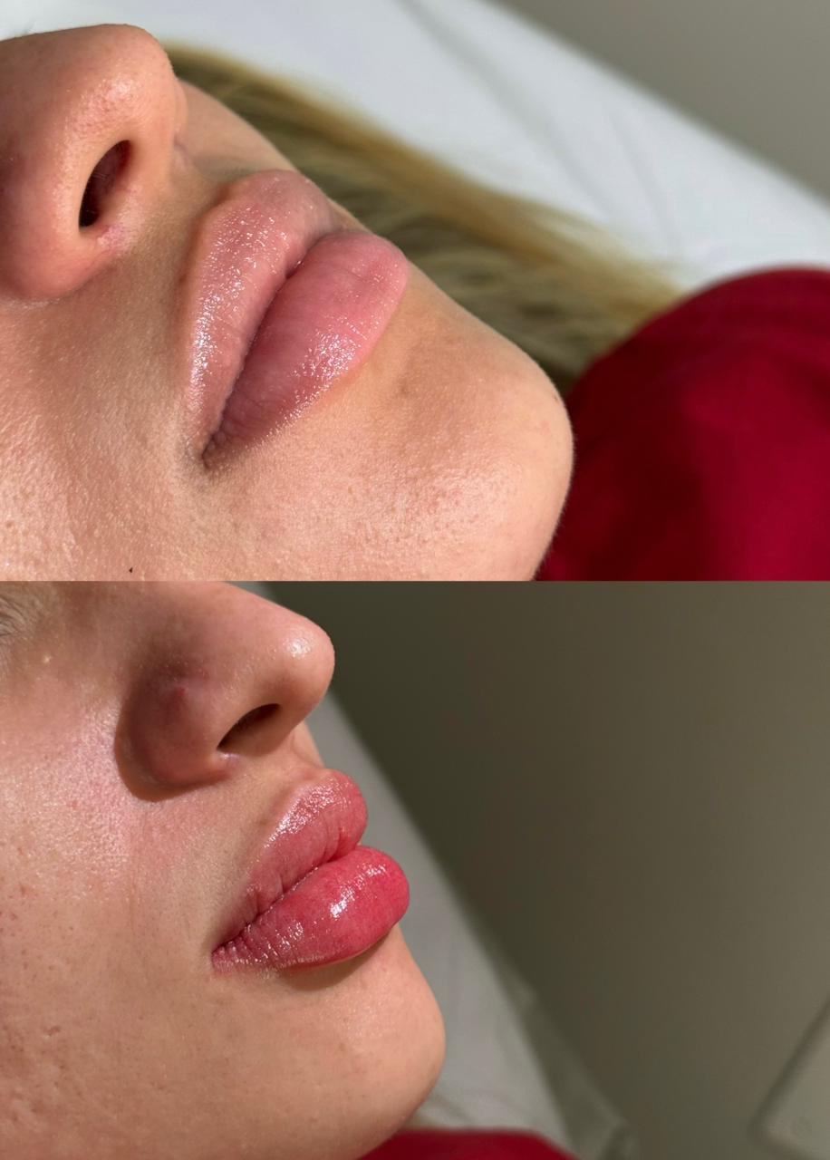Aos 24 anos, Mirna transforma a micropigmentação labial em uma assinatura de naturalidade, técnica e autoestima 46 e015fe00 18d7 4820 b527 2ce4c689339f